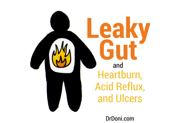 leaky gut, intestinal permeability, digestion, digestive system, intestines, inflammation, IBS, stress, healing leaky gut, heartburn, GERD, ulcers, acid reflux, reflux, stomach acid, antacids, antibiotics, dysbiosis, natural health